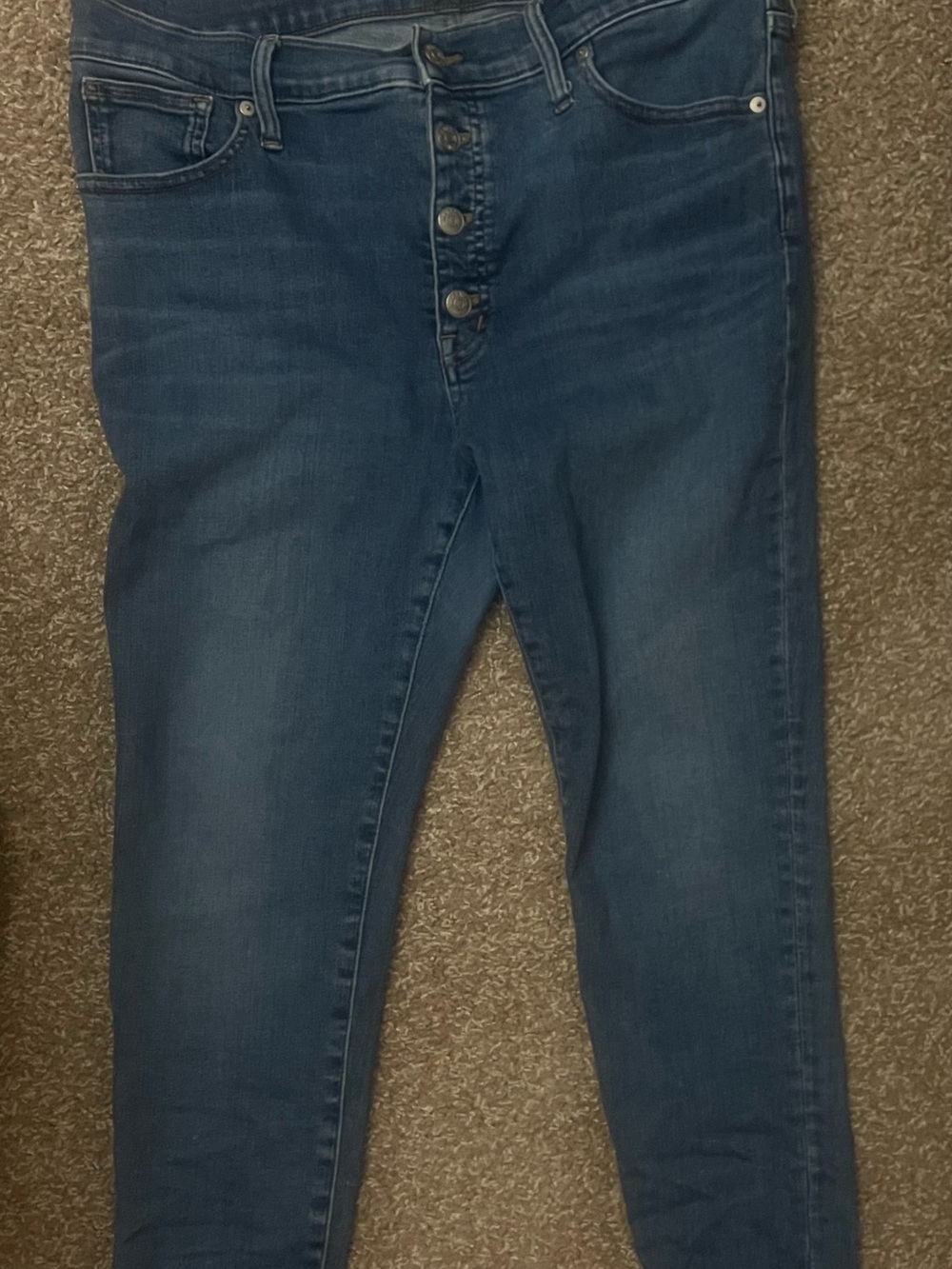 Madewell Light Blue Button-Fly Skinny Jeans